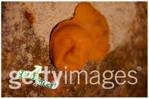 20091124065938_gum_faces-480x3191
